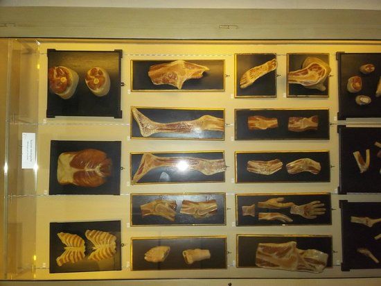 Collezione delle Cere Anatomiche "Luigi Cattaneo"